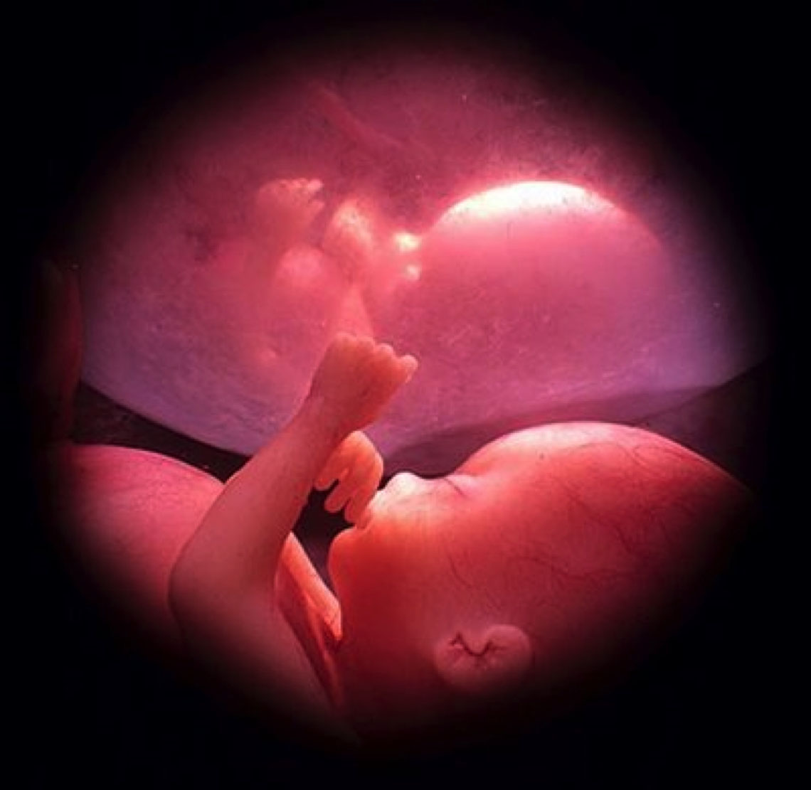 Home - Canberra Fetal Assessment Centre